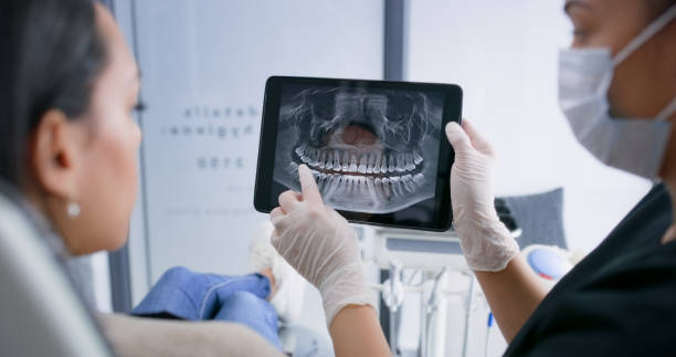 Licensed Wisdom Tooth Removal service in Lander, WY - Smile Center Dentistry